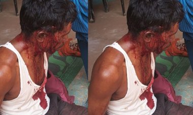 झाड़ियों में छुपे बाघ ने बकरी चराने वाले पर पीछे से किया हमला